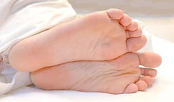 dry feet treatment melbourne